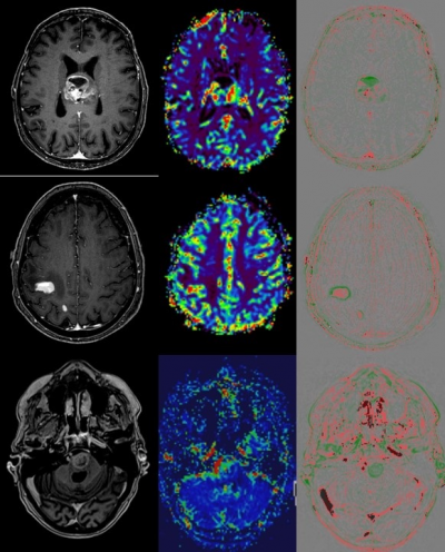 Advanced Imaging bei Erstdiagnose